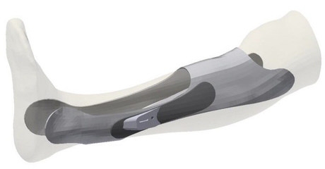 個(gè)性化加固設(shè)計(jì)的軟件工具，個(gè)性化加固設(shè)計(jì)的軟件工具