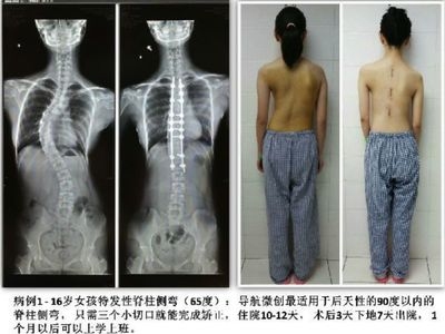 加固效果評(píng)估的實(shí)際案例